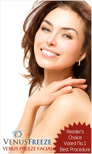 venus freeze facial