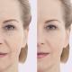 peptides