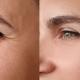 Treatments for the delicate eye area