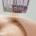 Unveiling the rejuvenating magic of microneedling