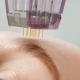Unveiling the rejuvenating magic of microneedling