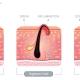 Navigating Ingrown Hairs and Shaving Rash